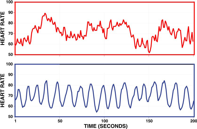 center-for-neuropotential-cnp-branford-CT-heartmath-rhythm-chart